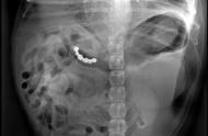狗狗们的X光片：吞针、吞刀、吞假牙，令人震惊！